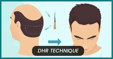 DHR Techniques in India 