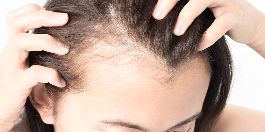 5 Reasons For Hair Loss in Women: Be More Considerate Next Time