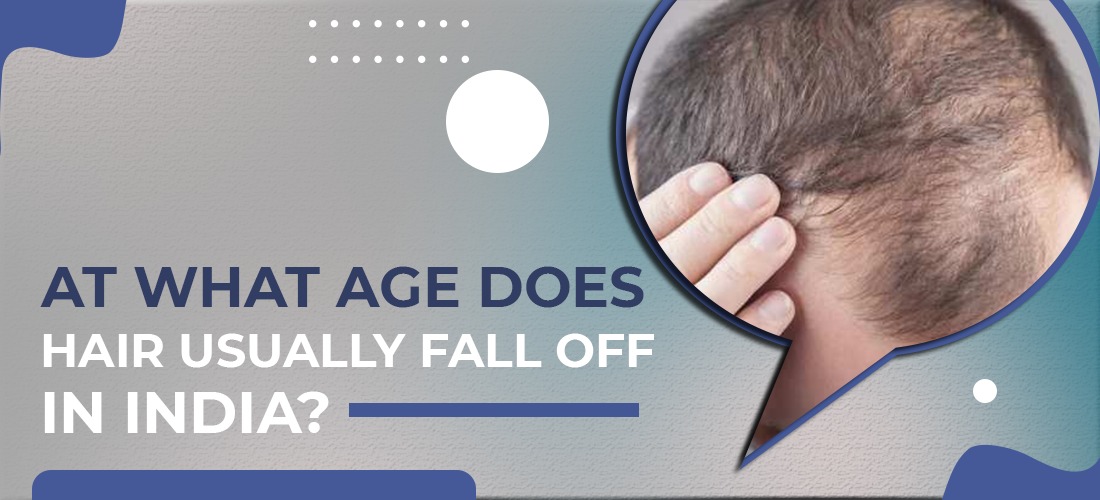  At what age does hair usually fall off in India?