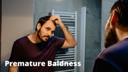 5 Reasons For Premature Baldness Experience The Hair Loss Treatment