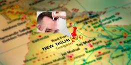 Top 4 Criteria To Choose the Best Hair Transplantation Clinic In Delhi